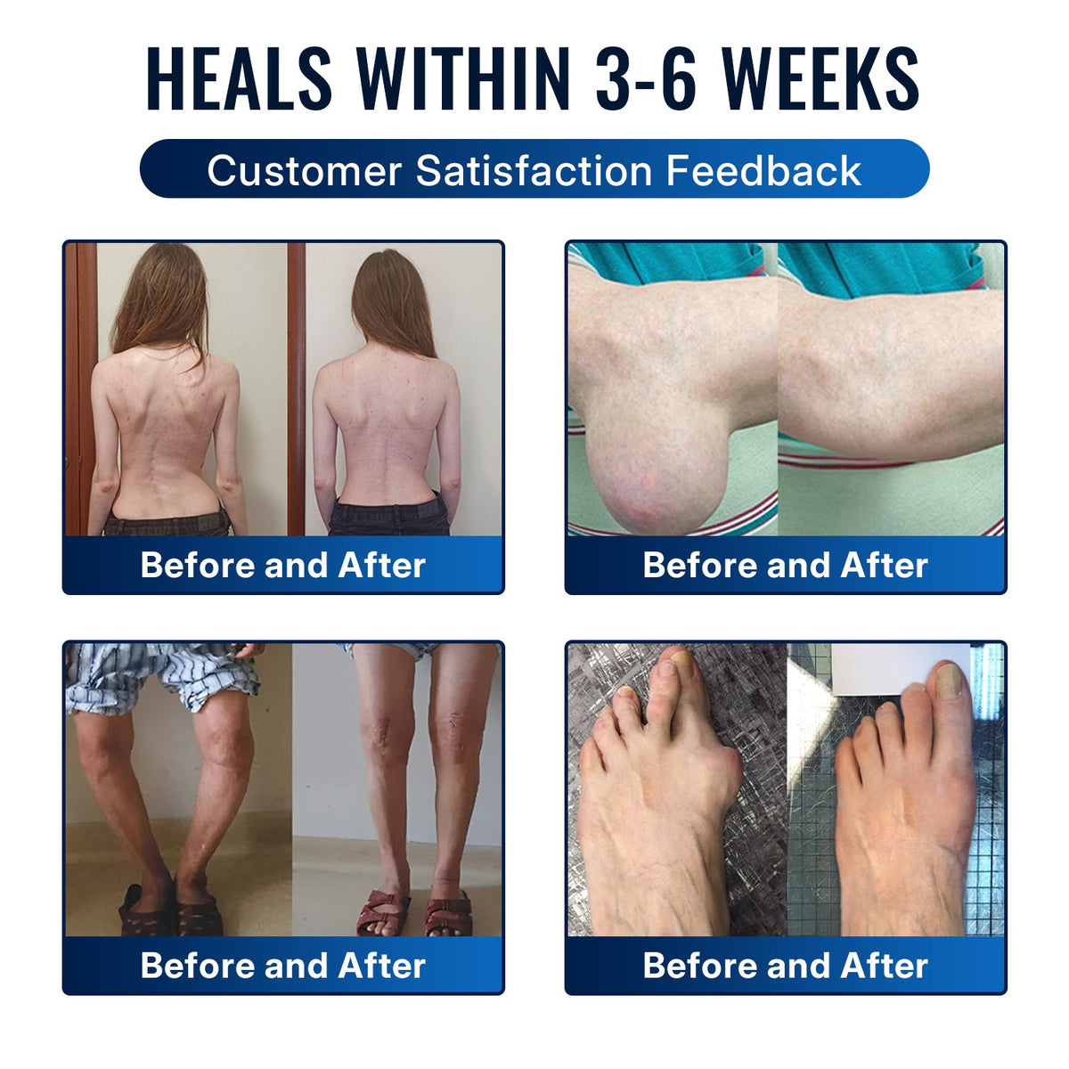 🛒 An additional 30% discount🎁Healrize®