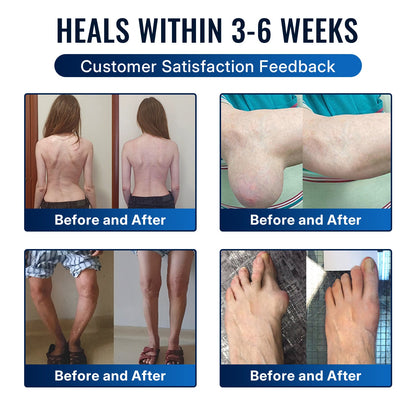 🛒 An additional 30% discount🎁Healrize®