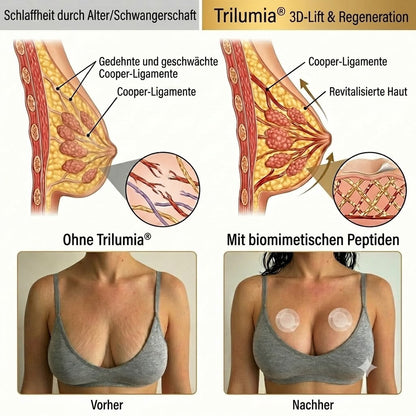 Trilumia® ✨Advanced Nano-Microneedle-Patch für mehr Brustvolumen & Straffung 🐏🐏