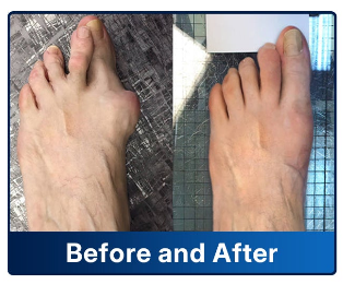 ✨Foot & Ankle Pain — Mobility Restore